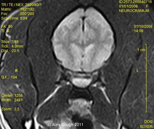 Boxers and sale seizures